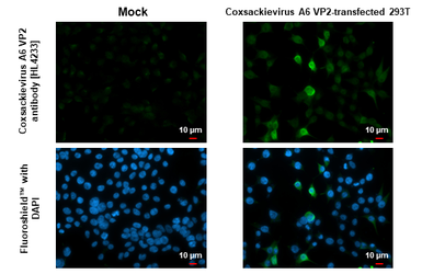 Anti-Coxsackievirus A6 VP2 antibody [HL4233] used in Immunocytochemistry/ Immunofluorescence (ICC/IF). GTX643066
